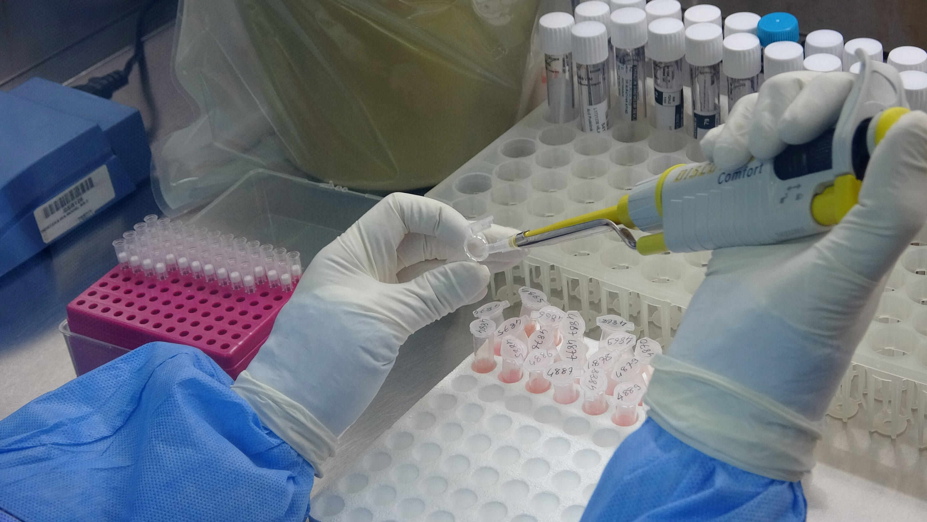 Prof. Dr. Aydın: Aşı olan süper bulaştırıcı olarak virüs taşıyabilir