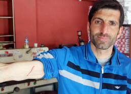 (ÖZEL) Futbol maçında dayak yiyen Suriyeli kaleci: Psikolojim bozuldu