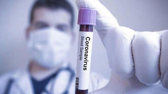 Koronavirüs salgınında günlük vaka sayısı 905 oldu