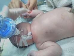 Doğum sırasında bebeğin köprücük kemiğinin kırıldığı iddiası (2)- Yeniden