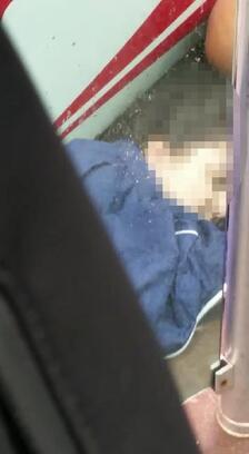 Tramvayın çarptığı genç kız yaralandı