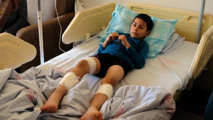 Sokak köpeklerinin saldırısına uğrayan küçük Mustafa yaralandı