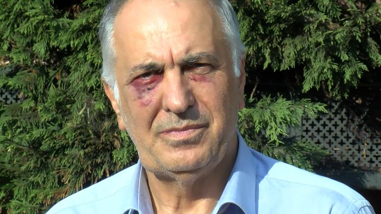 Saldırıya uğrayan Kartal Cemevi Başkanı Selami Sarıtaş, yaşananları anlattı