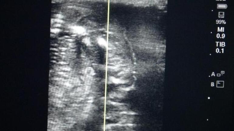 Türkiyenin embriyo transferiyle ilk tayları 8 ay sonra dünyaya gelecek